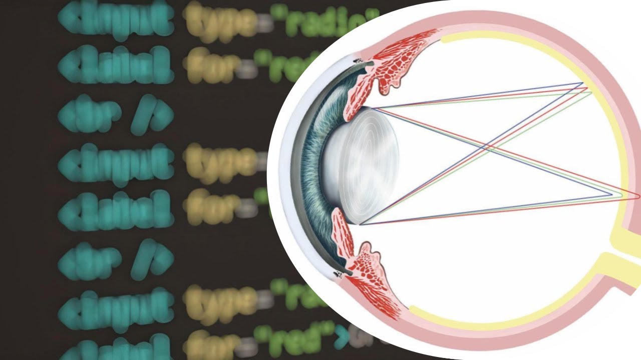 Blurry vision with displays: Chromatic aberration and RGB spectrum