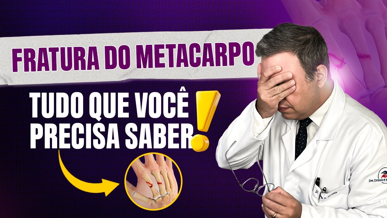 Fratura dos Metacarpos | Fratura da M&atilde;o