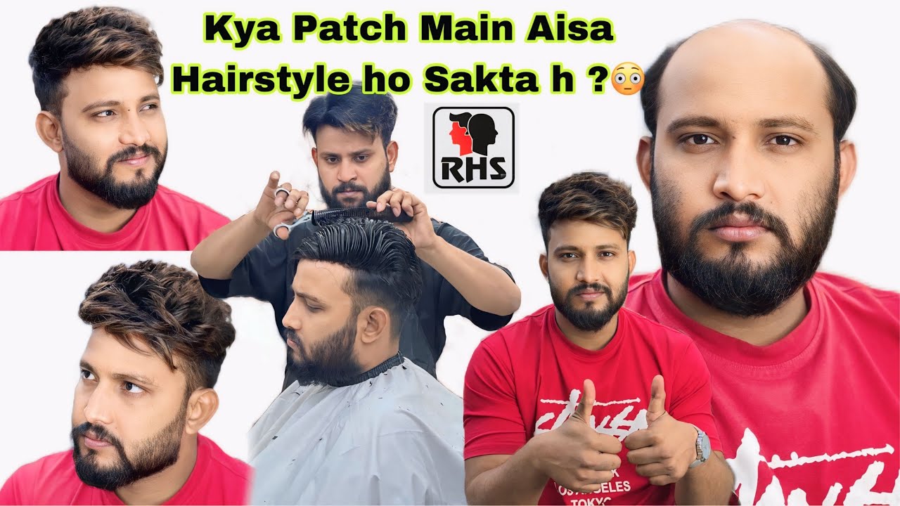 Best Hair Patch Centre | Natural Hairline Patch | Hair Patch For Men | 9599858612