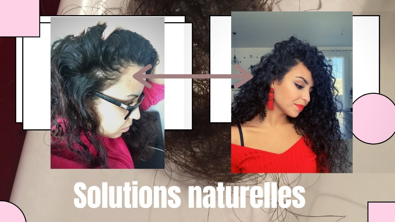 GROSSE CHUTE de cheveux, PELADE ou ALOPÉCIE ; les meilleurs remèdes naturelles !