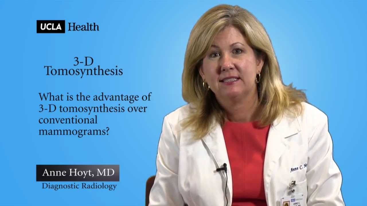 Real Questions | 3-D Tomosynthesis | UCLA Radiology
