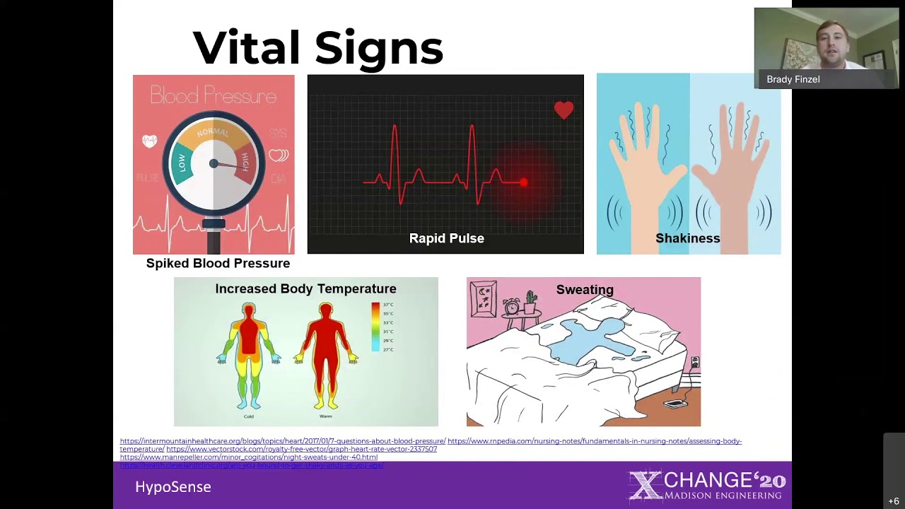 Using Vital Signs To Detect Nocturnal Hypoglycemia