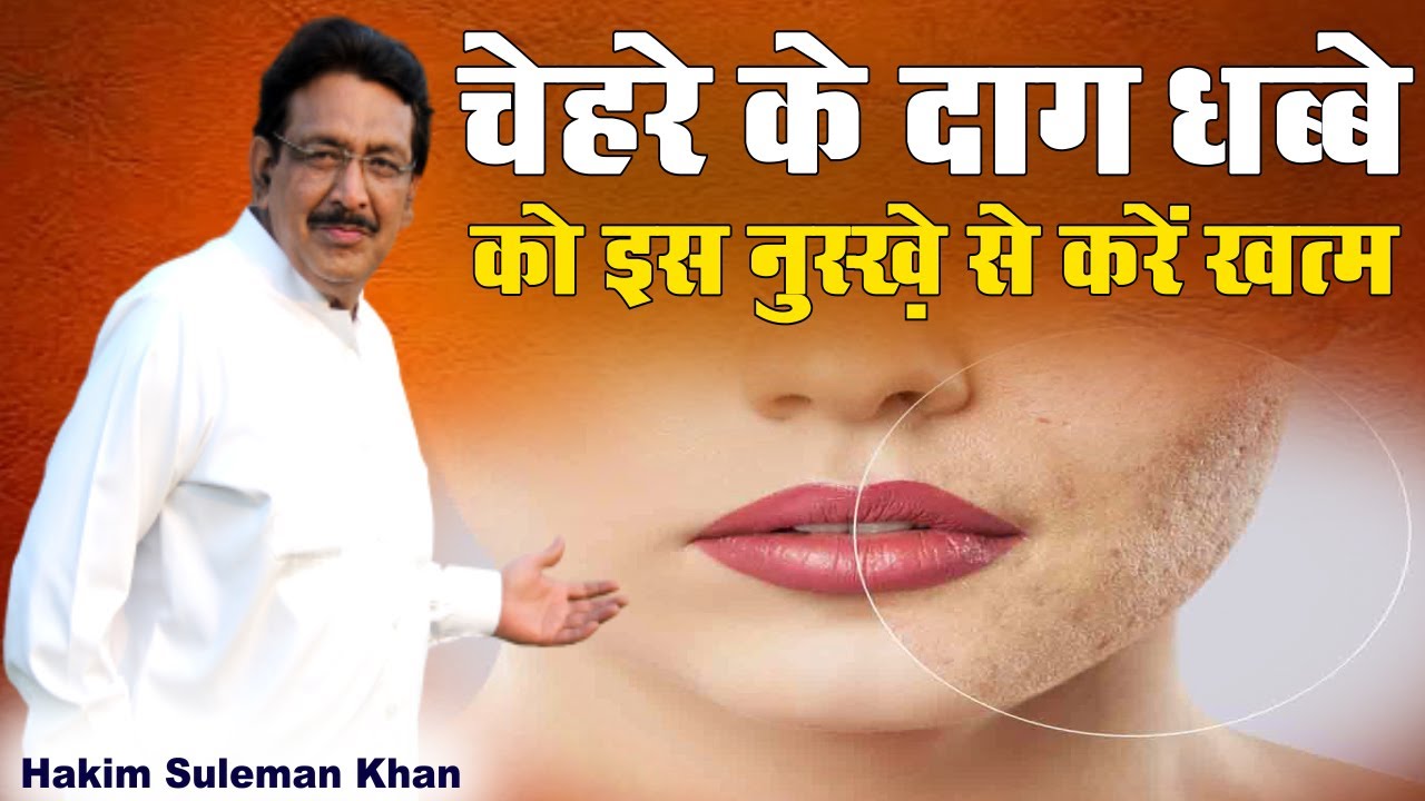 चेहरे के दाग धब्बे को करें खत्म अपनाएं ये नुस्ख़ा | Hakim Suleman Khan | Sadhna TV
