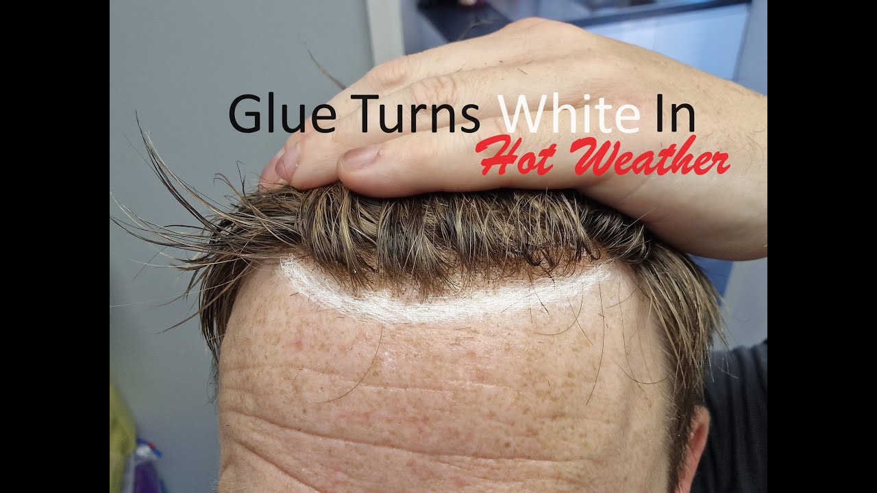 Hair System Fitting, with Taped Hairline due to heat, Then Glued Hairline, Compared, GLUE GOES WHITE