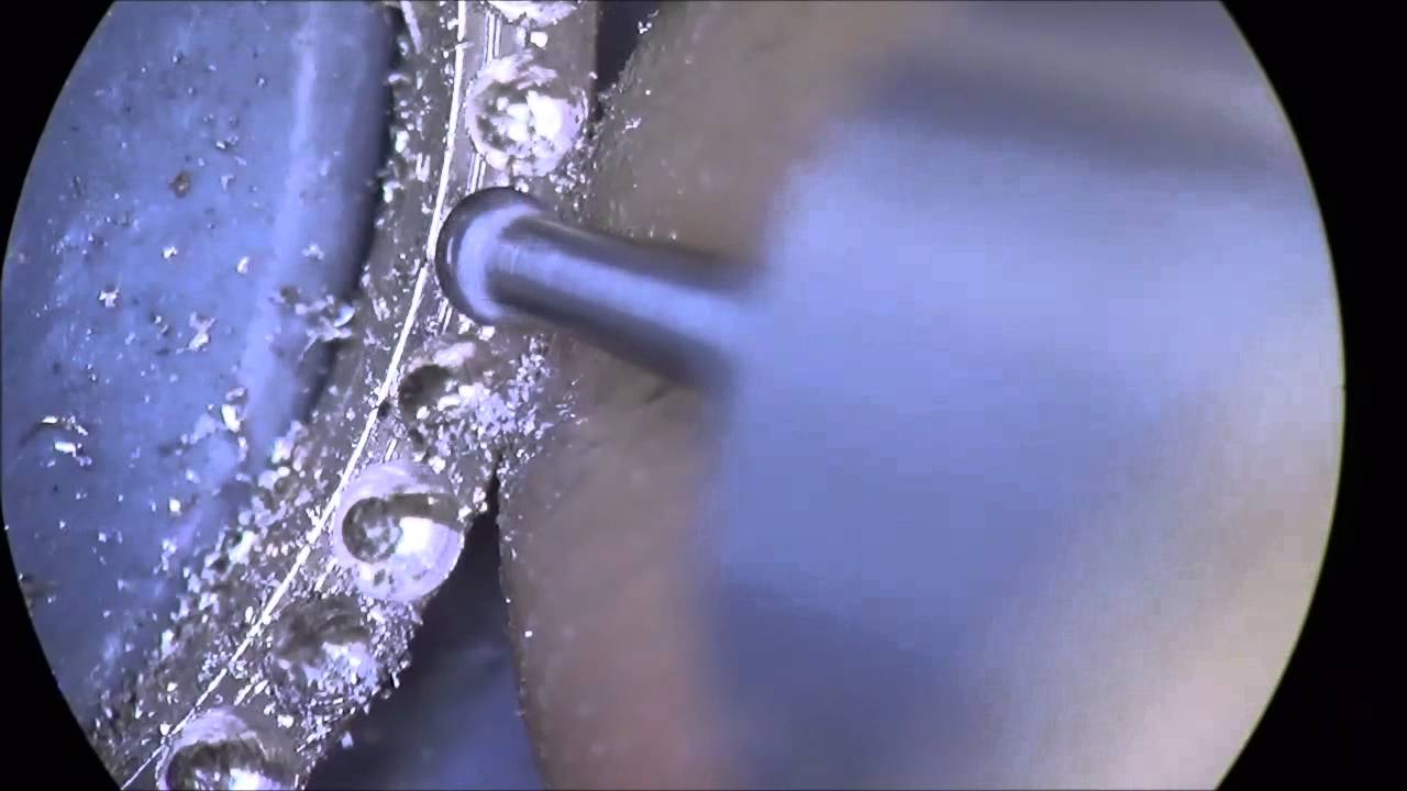Klever Ruiz (French Cut Ring)