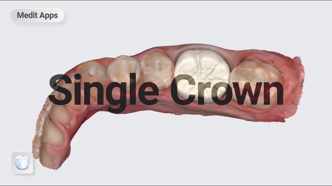 Designing a Single Crown with the Medit ClinicCAD App