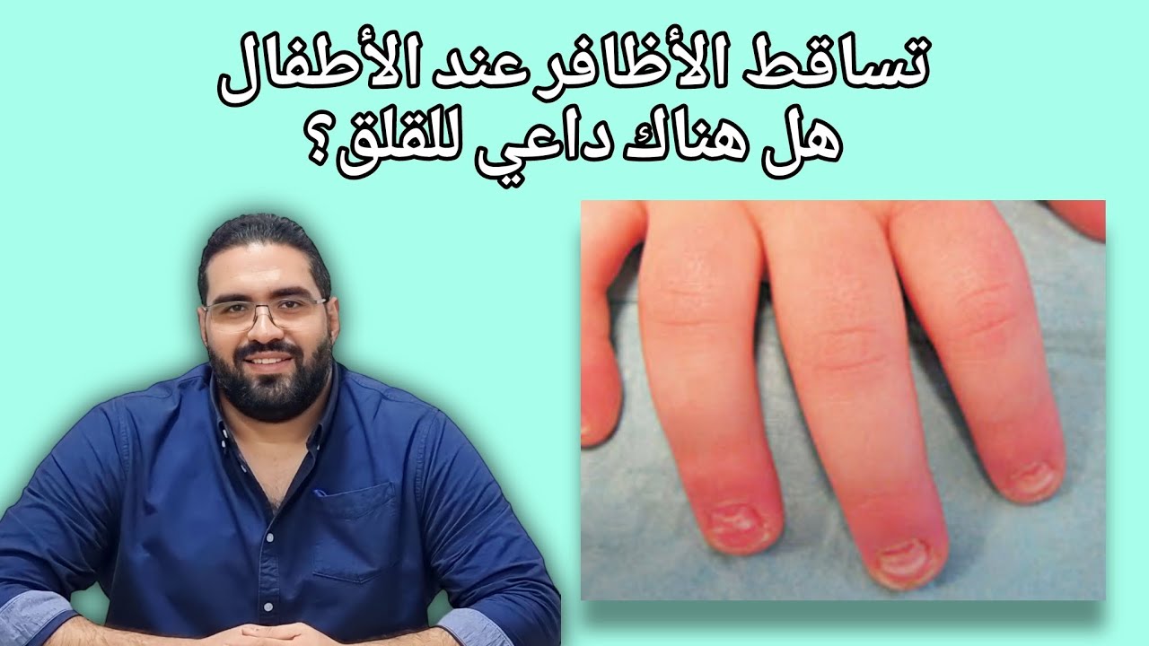 عيادة الجلدية - حلقة ٣٠ - تساقط الأظافر عند الأطفال