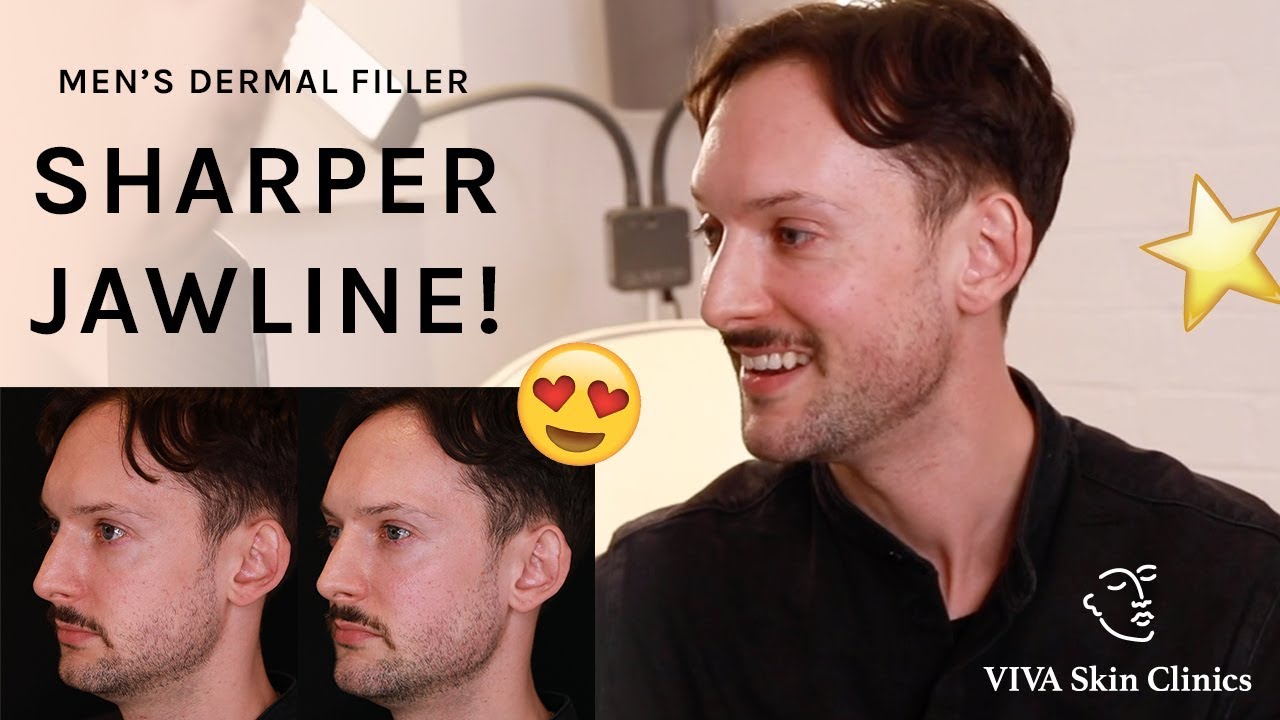 Creating A Sharper Jawline With Dermal Fillers | Men's Jawline Enhancement VIVA Skin Clinics London