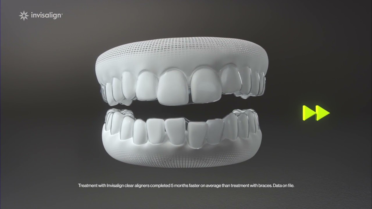 Invisalign Aligners for Teens - Sandhurst Family Dental Clinic - Toronto Family Dentists