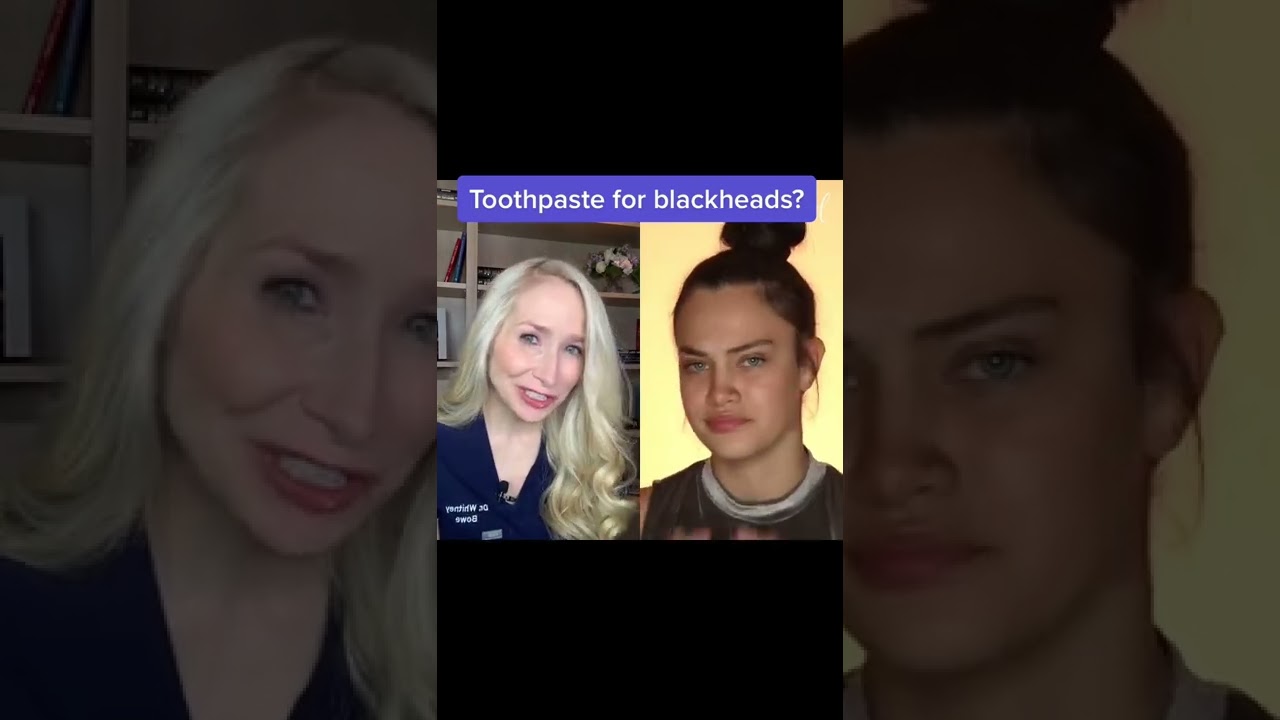 Зубная паста от черных точек?
