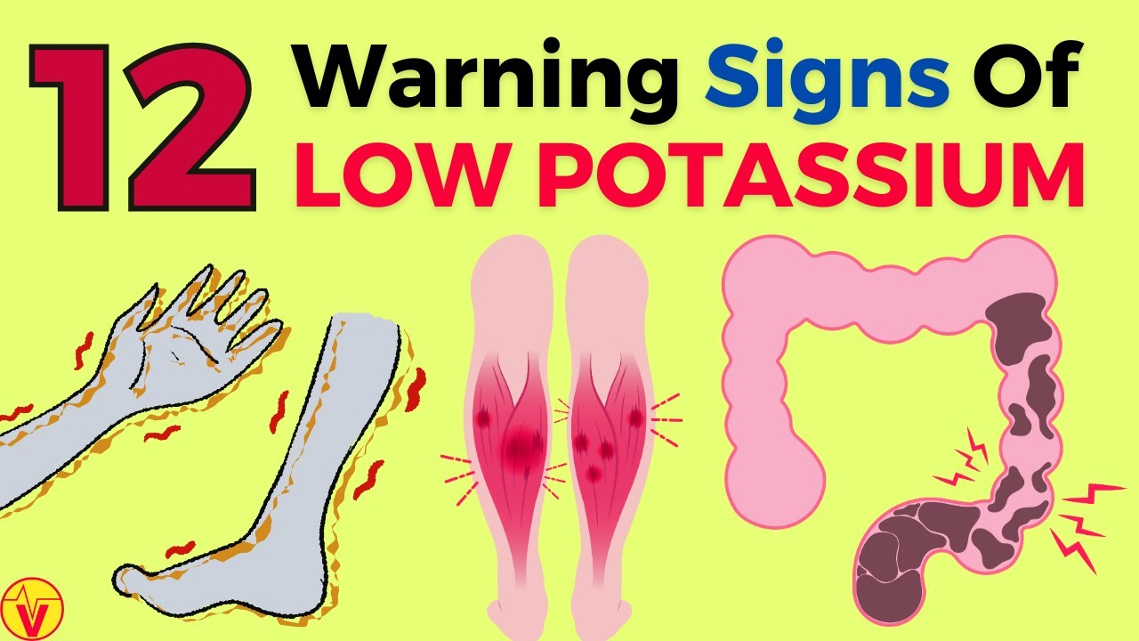 12 Warning Signs Of Low Potassium In The Body (Don't Ignore These!)| Potassium Deficiency | VisitJoy