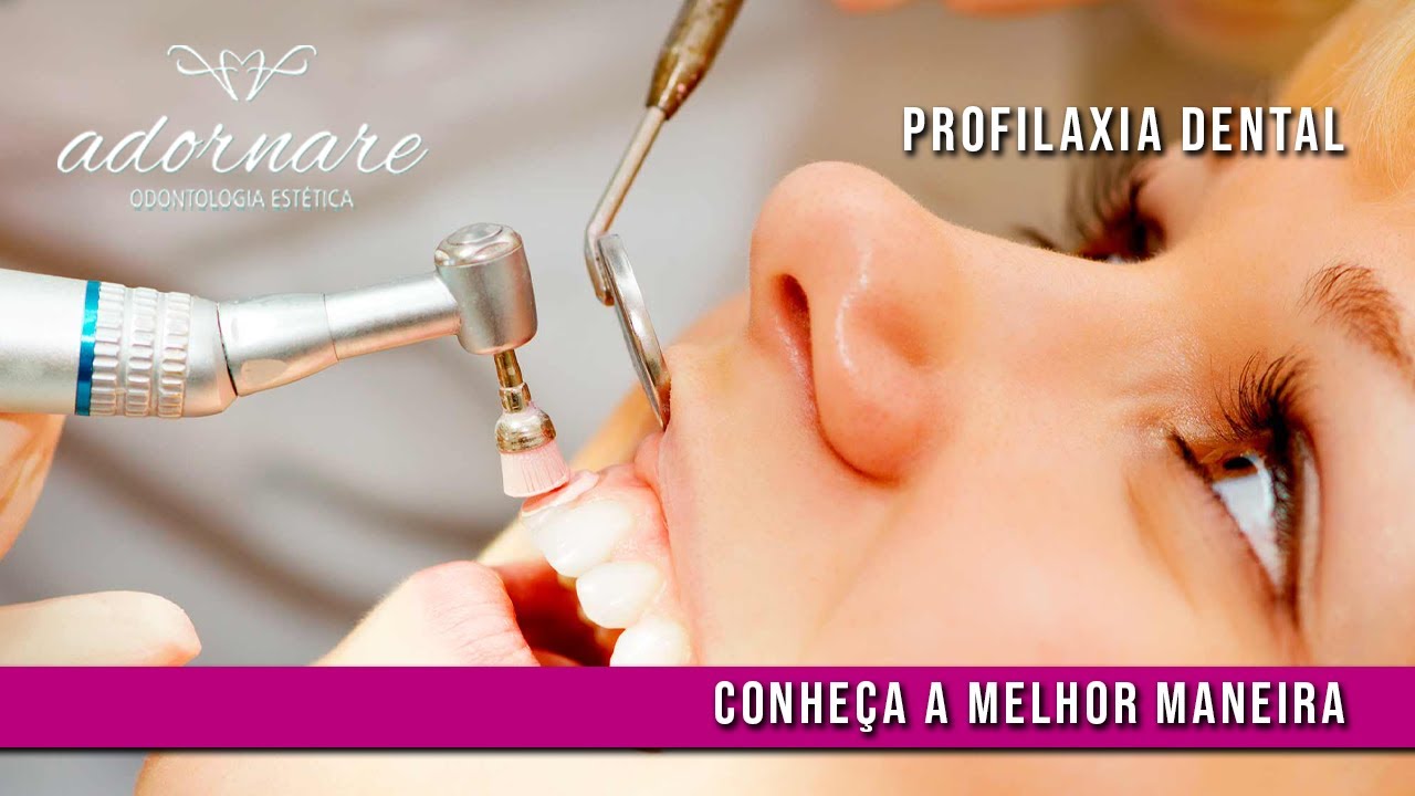 As Etapas da Profilaxia Dental ou Limpeza Dentária - Conheça sobre - Dicas de Saúde Bucal
