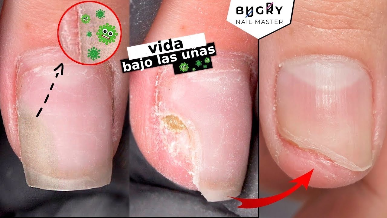 HONGOS EN LAS UÑAS🙈💅 Qué deben hacer el maestro y el cliente? || Consejos de cuidado