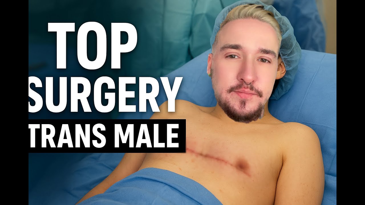TRANSGENDER TOP SURGERY ON THE NHS IN THE UK