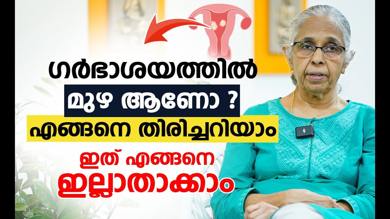 ഫൈബ്രോയ്ഡ് മുഴ ആണോ ? എങ്ങനെ തിരിച്ചറിയാം | Fibroid Removal Malayalam