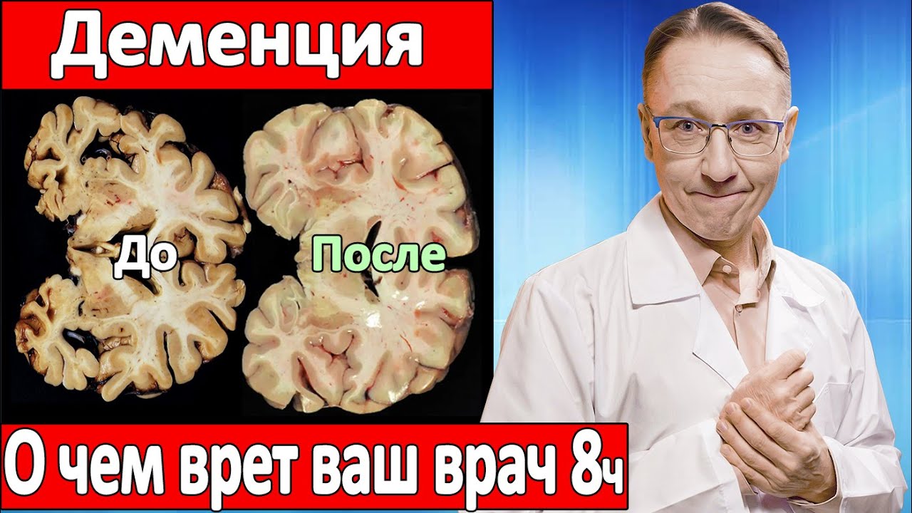 Избежать болезнь Альцгеймера и ВЫЛЕЧИТЬ деменцию. О чем врет ваш врач 8 часть