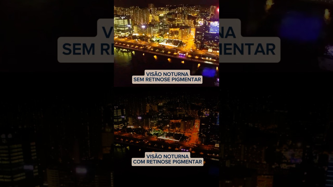 Comparativo de visão com e sem retinose pigmentar