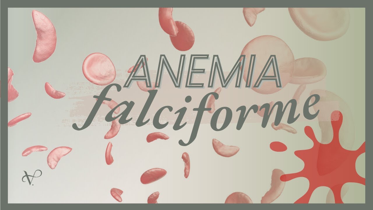 ANEMIA FALCIFORME - O QUE VOCÊ PRECISA SABER
