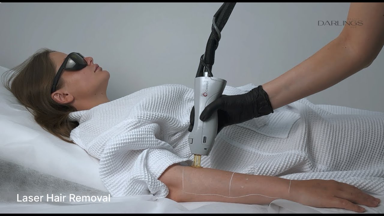Laser Hair Removal at Darlings Beauty Lab (Candela GentleMax Pro)