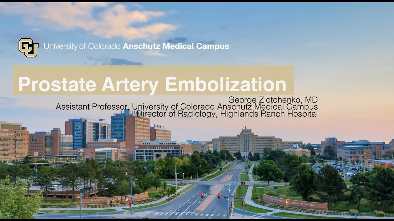 SIR-RFS Webinar: Introduction to Prostate Artery Embolization (11/30/22)