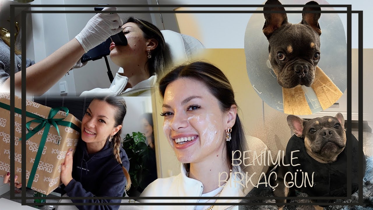 MASSETER BOTOKS YAPTIRDIM, Dudak Dolgumu Erittik, Saç Prp, Köpeklerim Kısırlaşıyor II VLOG