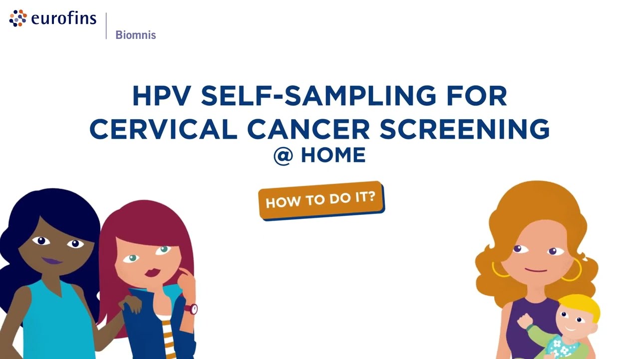 How to&hellip; ? HPV self-sampling for cervical cancer screening
