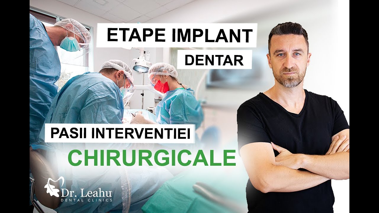 Cate implanturi dentare se pot pune intr-o singura sedinta