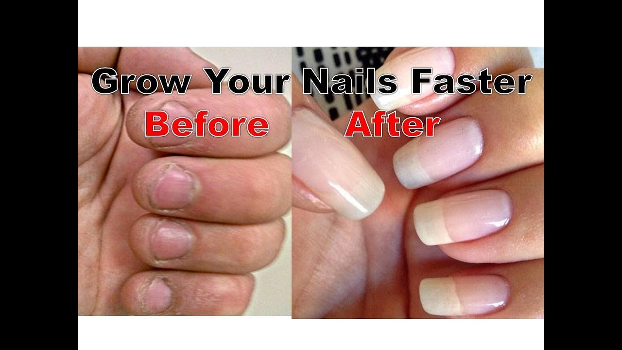 How to grow Nails Faster at Home | Easy Nails Growth idea | how to grow long nails