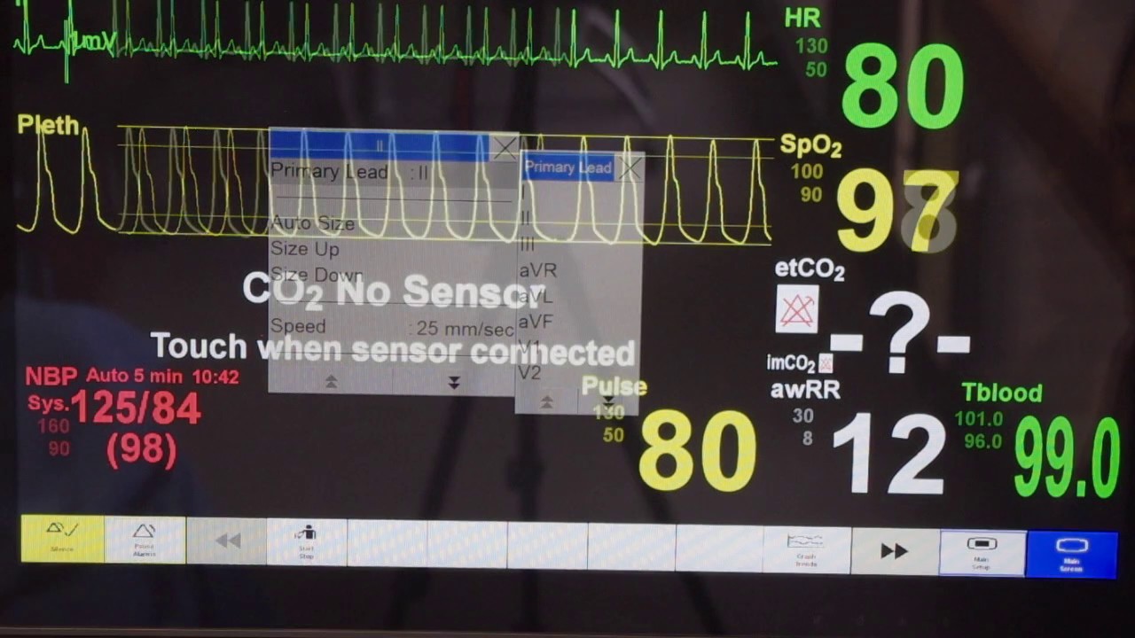 Patient Monitor Tutorial