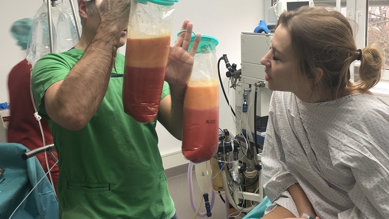 Mon opération : Adieu le lipoedème !