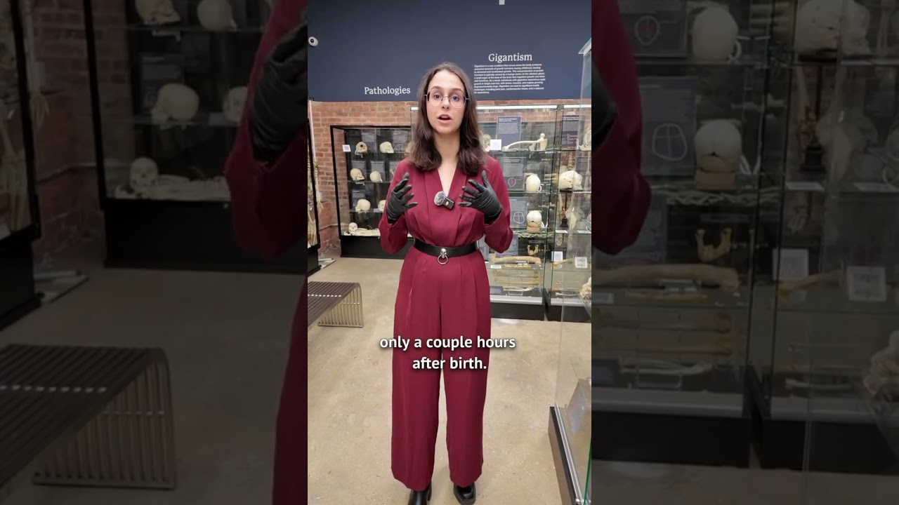 Что такое анэнцефалия?