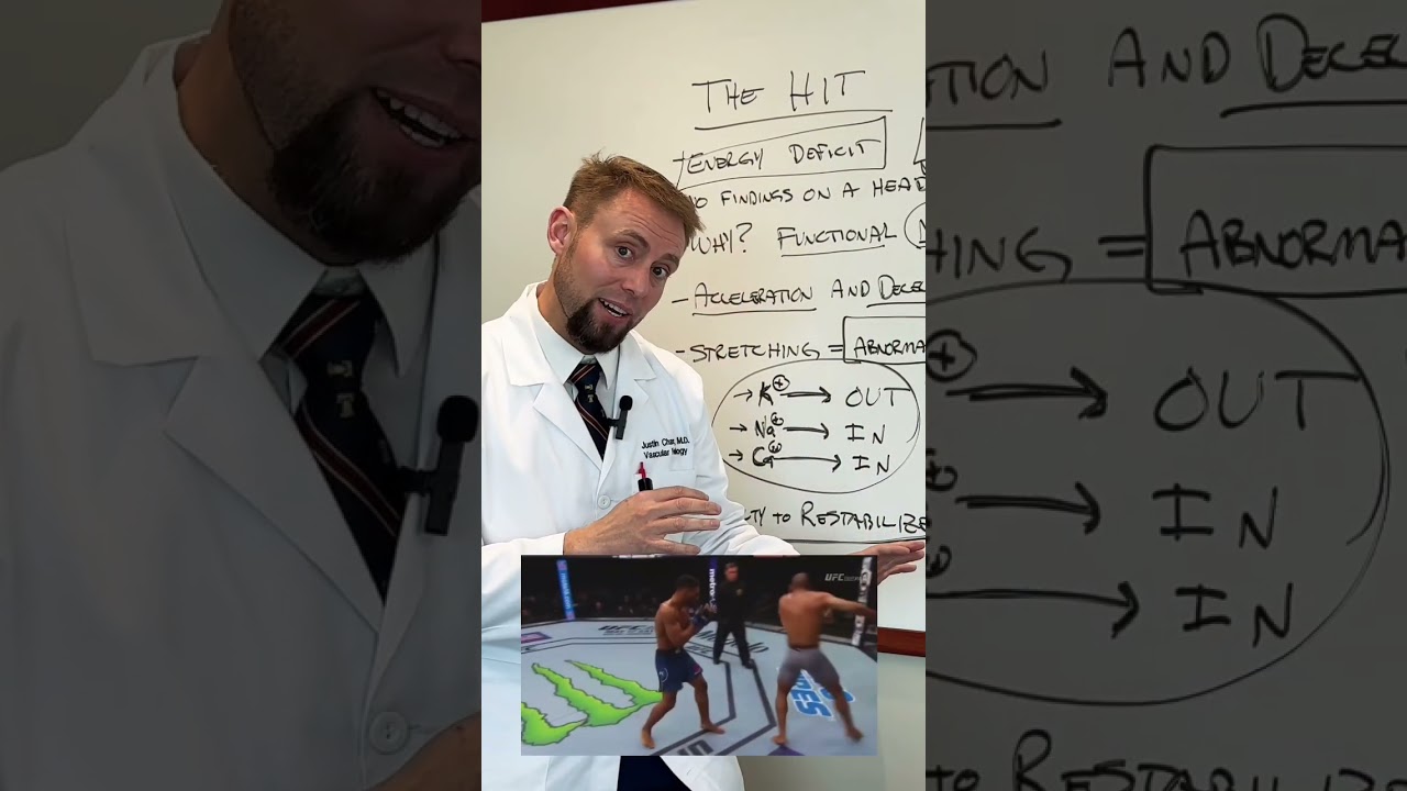 Brain Doctor | Second Impact Syndrome Concussions.