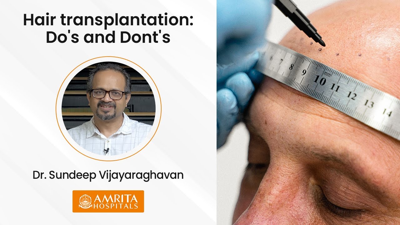 Hair Transplant Surgery-Amrita Hospitals