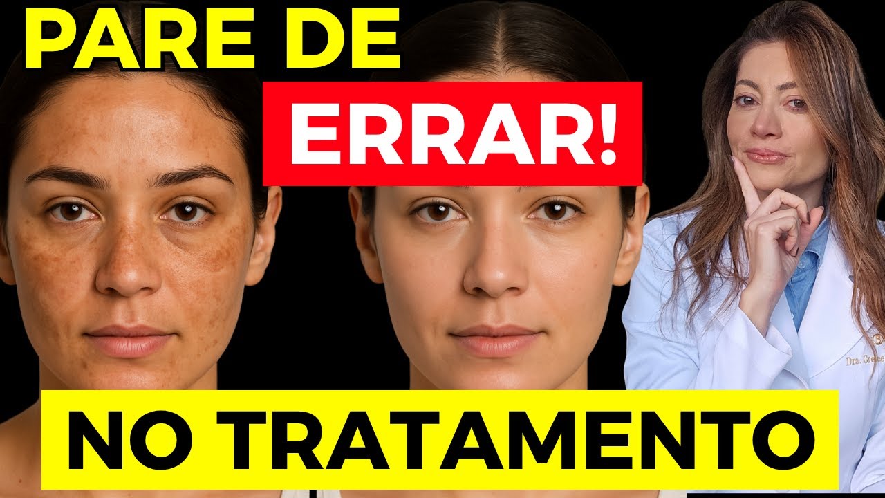 Como Clarear o Melasma de Verdade – Produtos Que Realmente Funcionam! | Dra. Greice Moraes