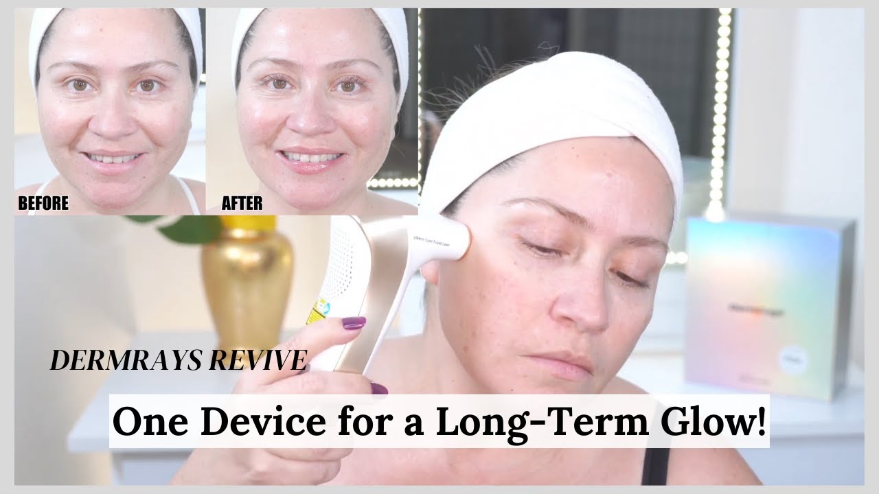 One Device for a Long-Term Glow ✨| DermRays Revive Results