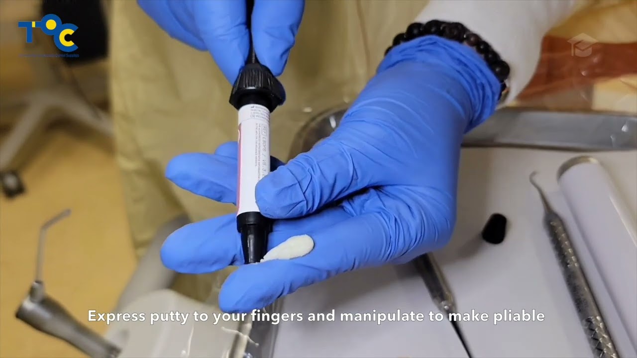 Perfect-A-Smile Pontic Putty Application