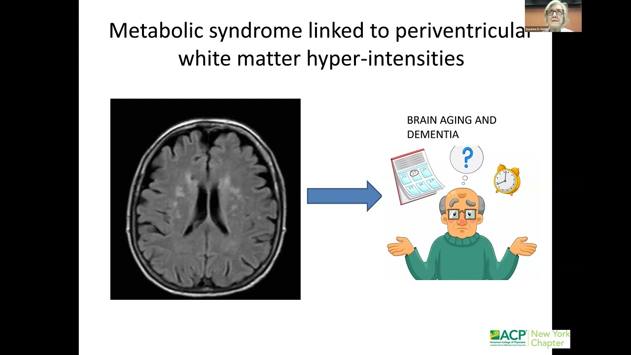 Advances in Biomarkers and Treatment of Alzheimer's Disease