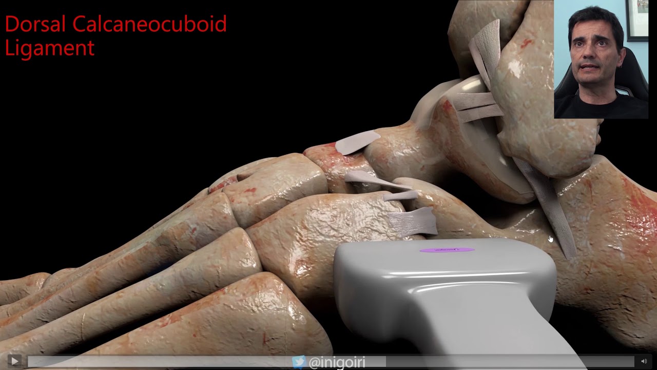 ANATOMIA Y ECOGRAFIA LIGAMENTOS EXTERNOS TOBILLO