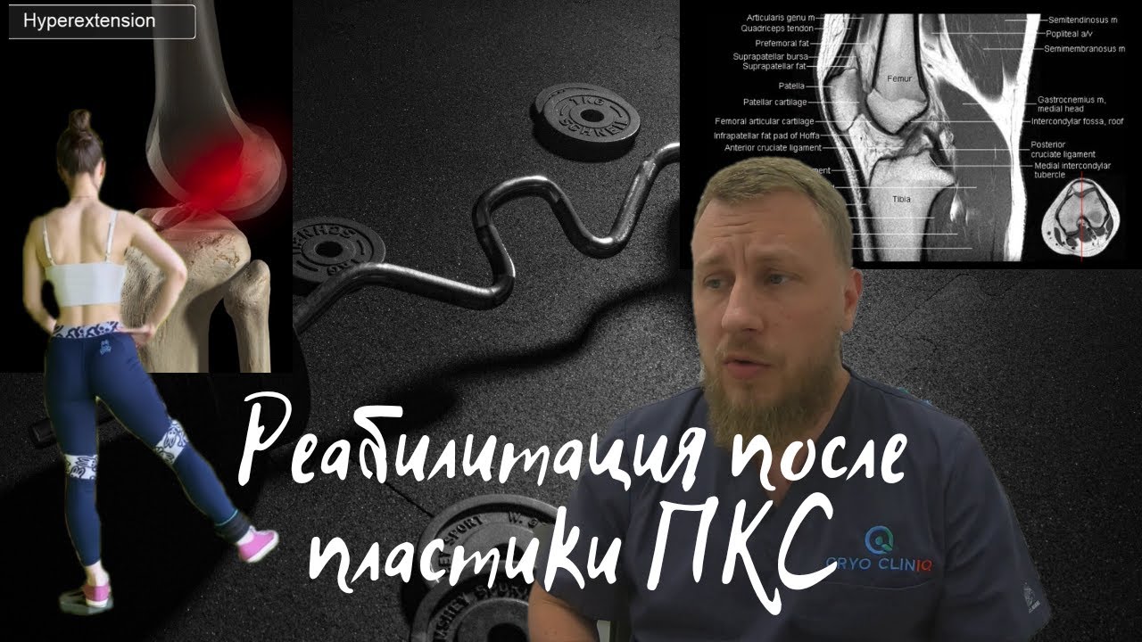 Восстановление после пластики передней крестообразной связки