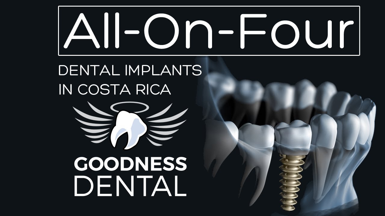 All on 4 Dental Implants in Costa Rica