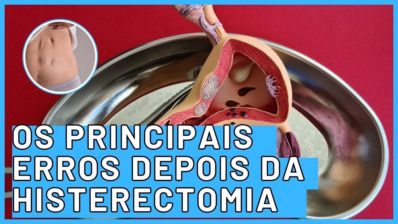 7 Erros Após a Histerectomia Que Podem Prejudicar Sua Recuperação