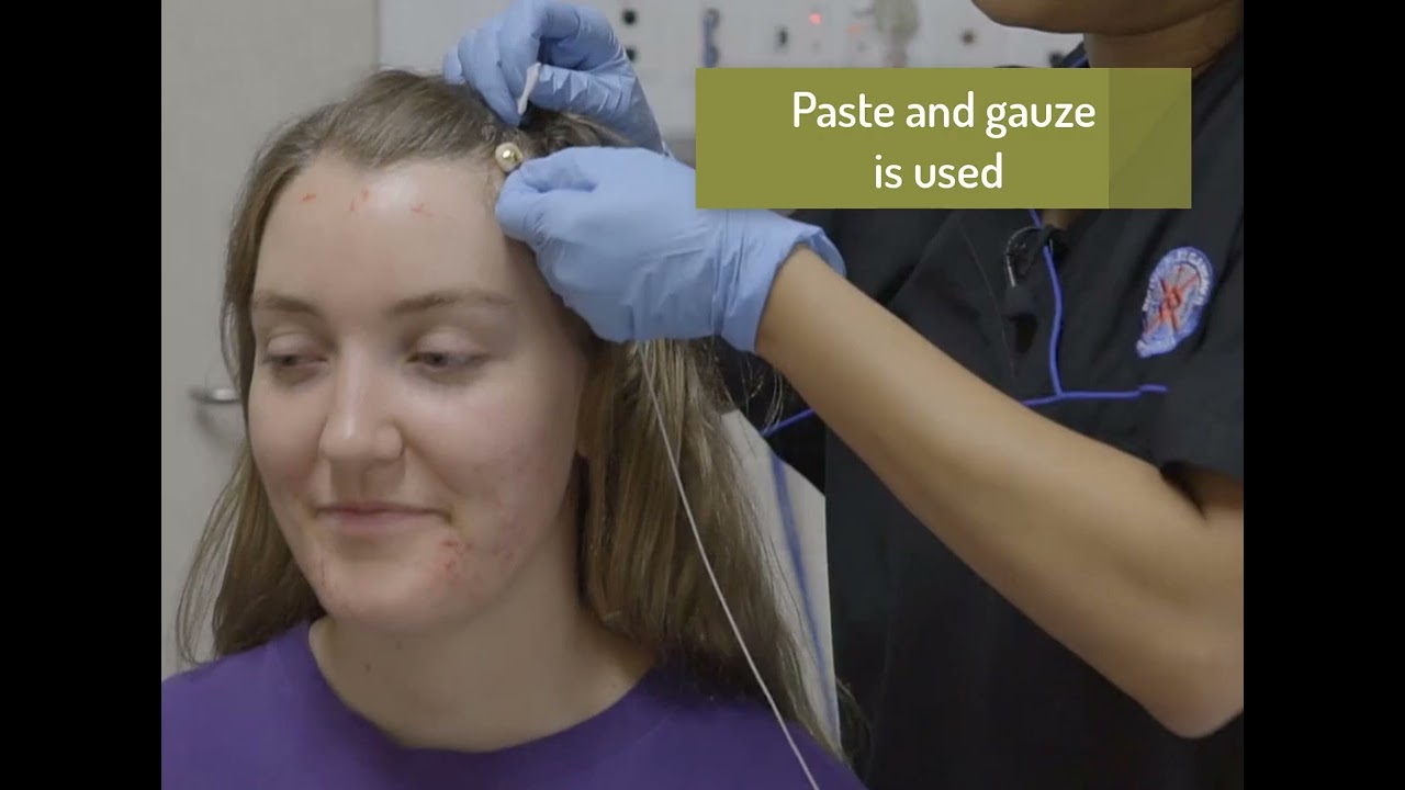 Setting up a sleep study