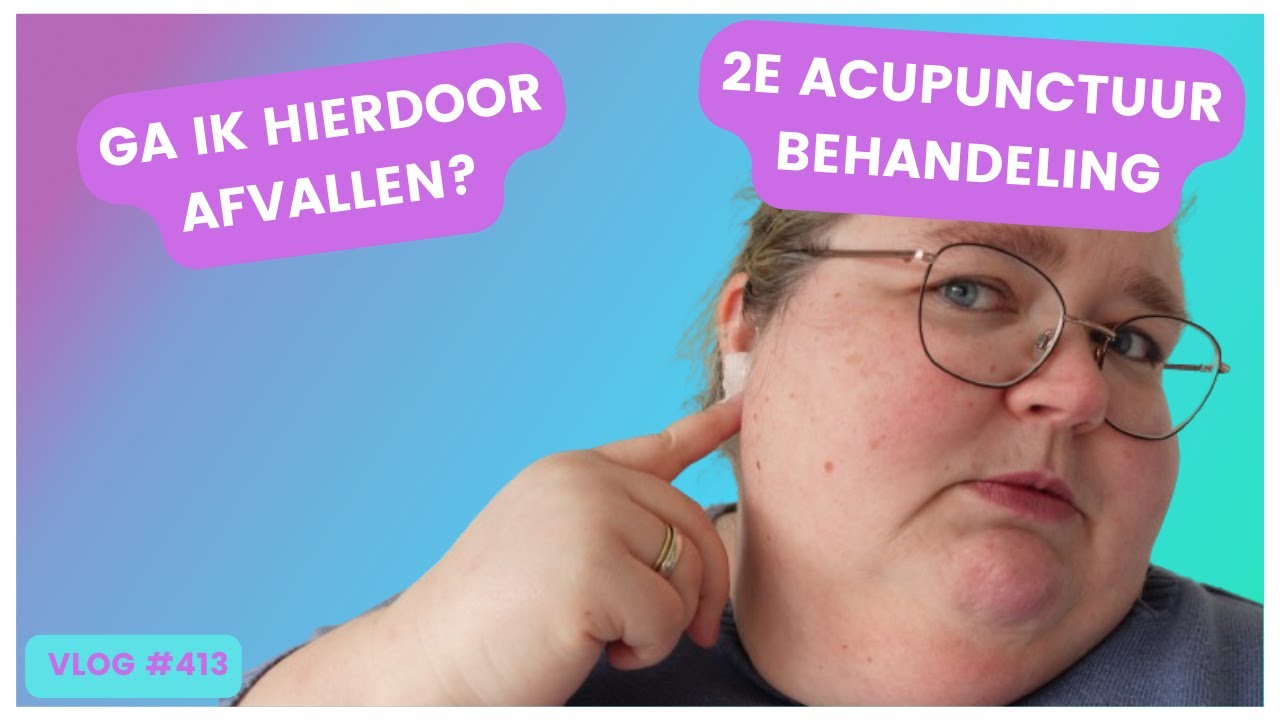 AFVALLEN DOOR ACUPUNCTUUR BEHANDELING ?| BOVENLIP HARSEN :) | DANIELLE VLOGT #VLOG 413