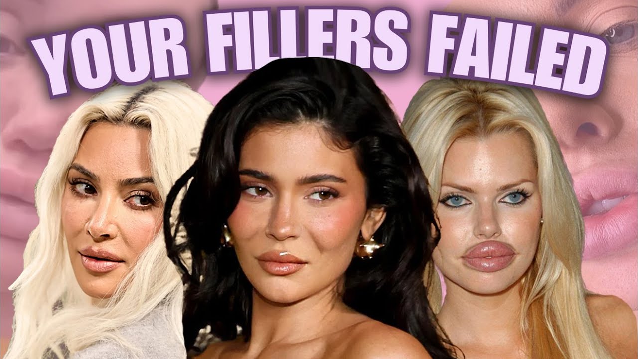your fillers have failed you.