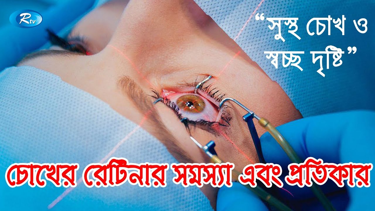 চোখের রেটিনার সমস্যা এবং প্রতিকার | Shustho Chokh | Rtv Health Program