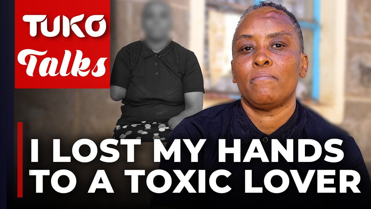 My ex-husband disfigured me so that I can never be attractive to other men | Tuko TV