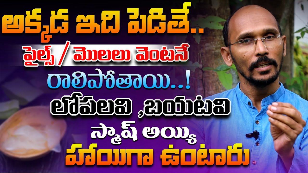 ఇది పెడితే..పైల్స్ మొలలు వెంటనే రాలిపోతాయి ! లోపలవి ,బయటవి స్మాష్ | Dr.MadhuBabu | Health Trends |