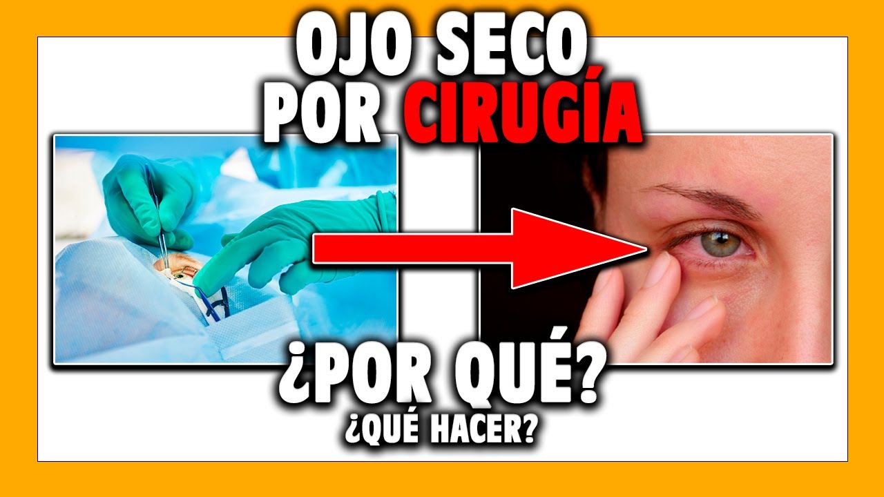 🟡 OJO SECO después de cirugía... ¿Qué hago?