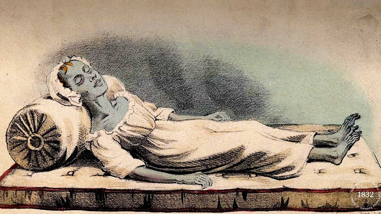 The Blue Death in Belfast: The Cholera Epidemic of 1832