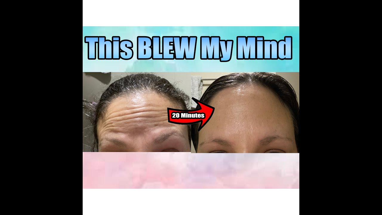 Reduce Wrinkles In 20 Minutes! Filorga Meso Mask Full Review